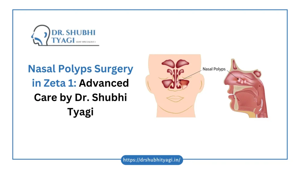 Nasal Polyps Surgery in Zeta 1