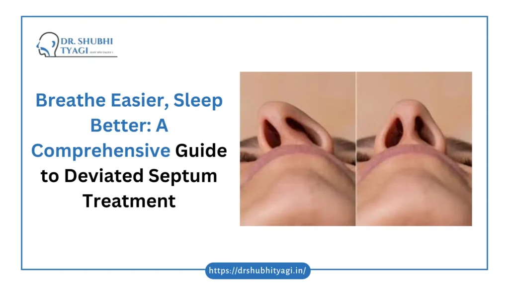 Deviated Septum treatment in Alpha 3