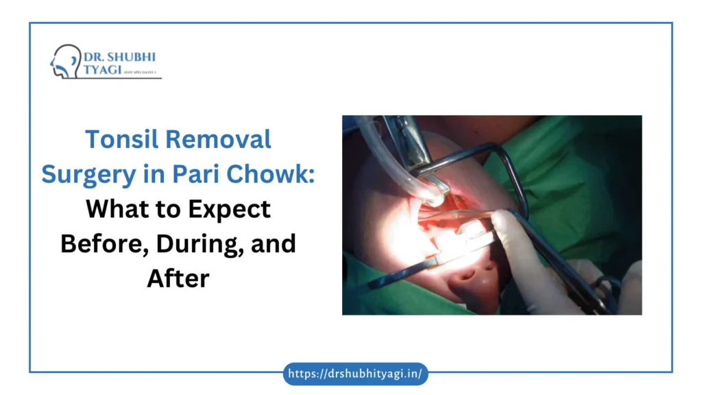 Tonsil Removal Surgery in Pari Chowk