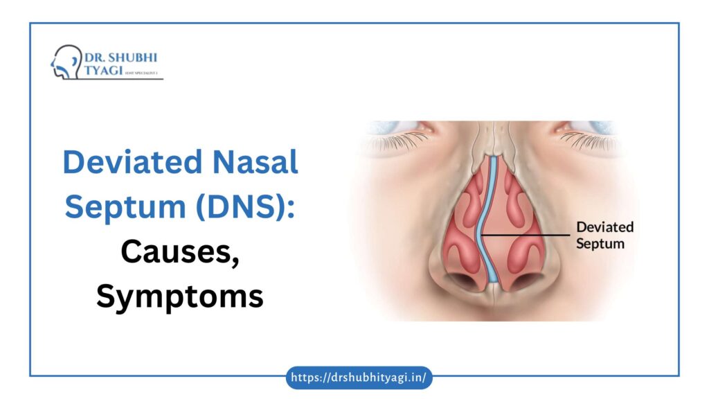 Deviated Nasal Septum (DNS): Causes, Symptoms, and Expert DNS Surgery for a Breath of Fresh Air in Noida