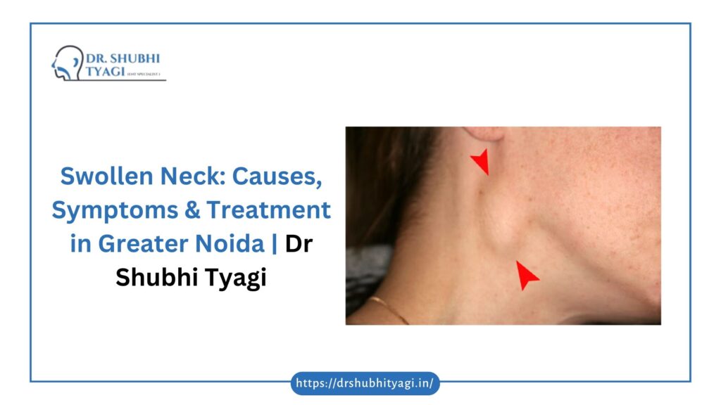 Swollen Neck Causes & Treatment in Greater Noida