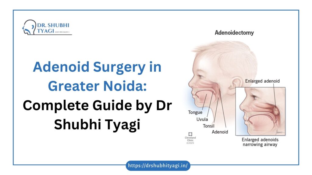 adenoid surgery in Greater Noida