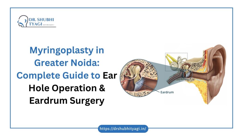 Myringoplasty in Greater Noida | Ear Hole Surgery