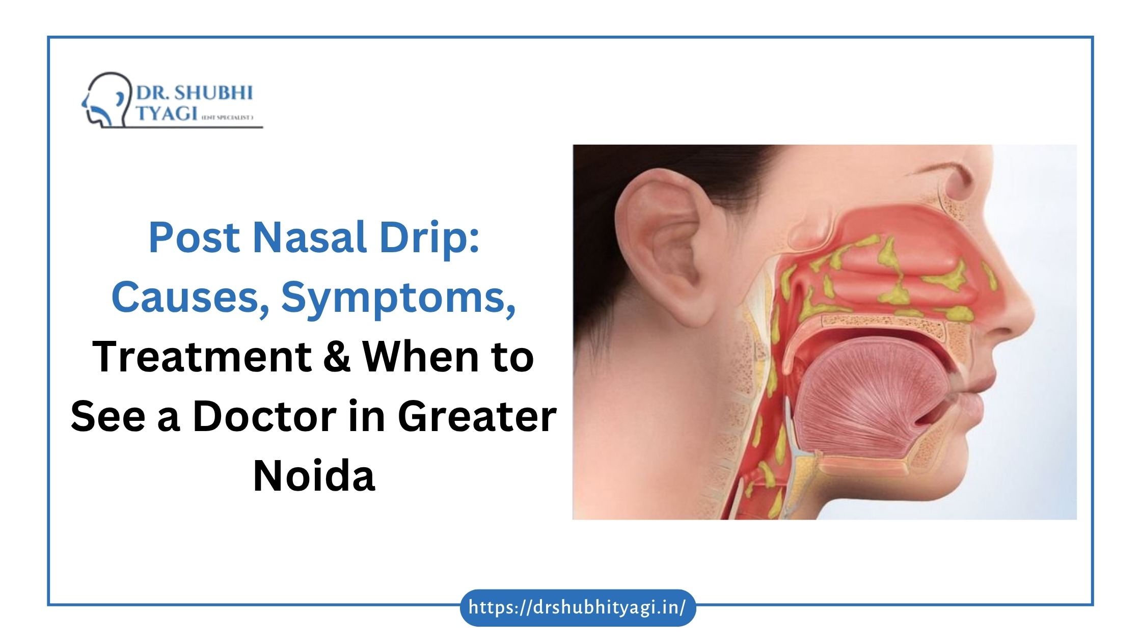 Post Nasal Drip Causes, Symptoms, Treatment & When to See an ENT Doctor in Greater Noida Post Nasal Drip Causes, Symptoms, Treatment & When to See an ENT Doctor in Greater Noida