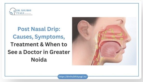 Post Nasal Drip Causes, Symptoms, Treatment & When to See an ENT Doctor in Greater Noida