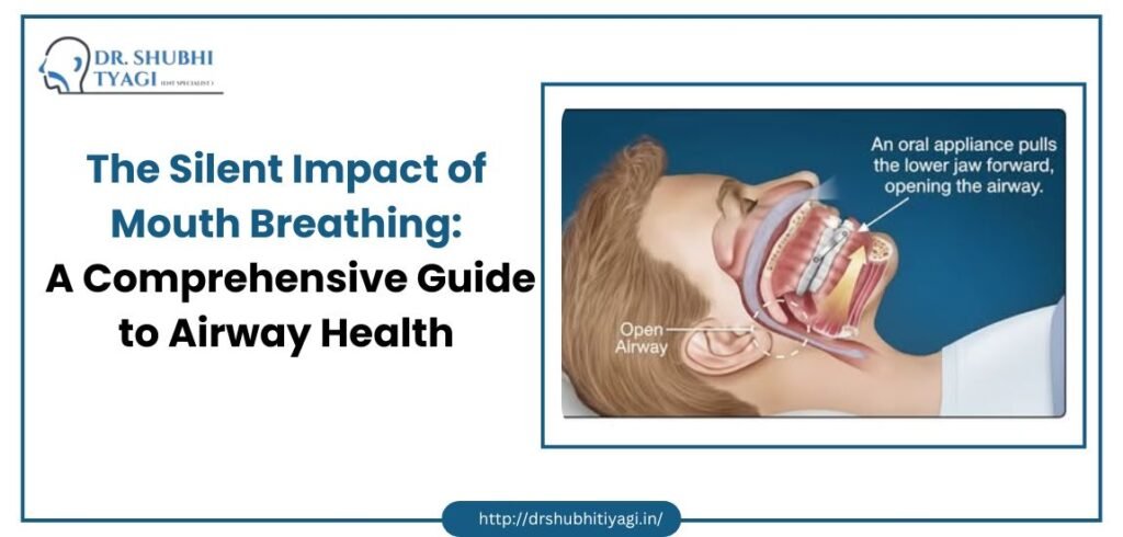 The Silent Impact of Mouth Breathing: A Comprehensive Guide to Airway Health