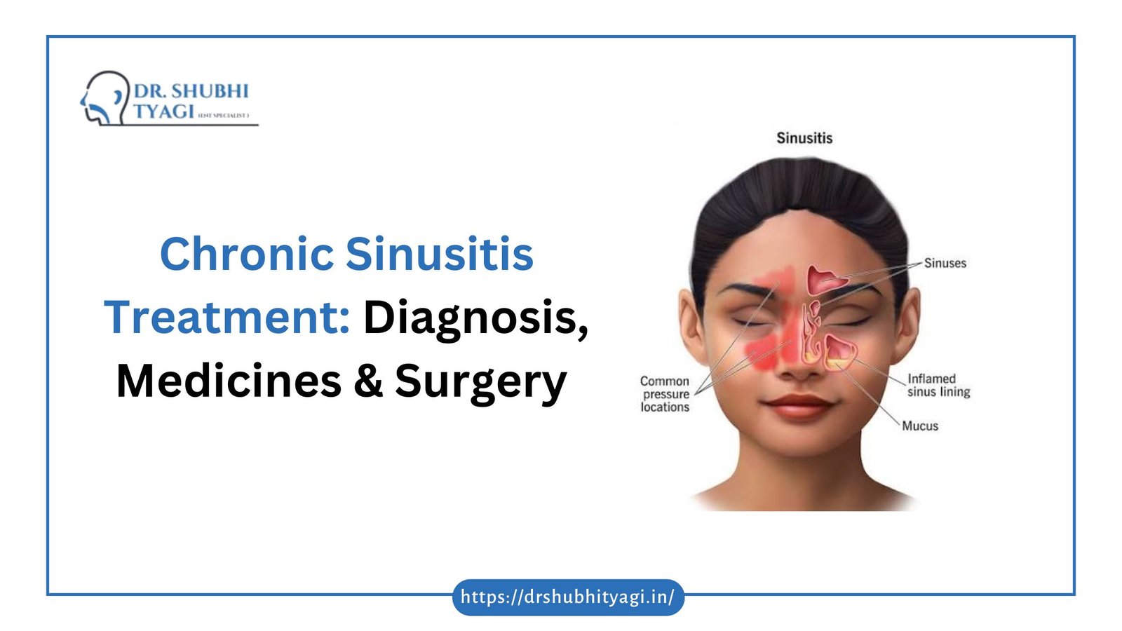 Chronic Sinusitis Treatment