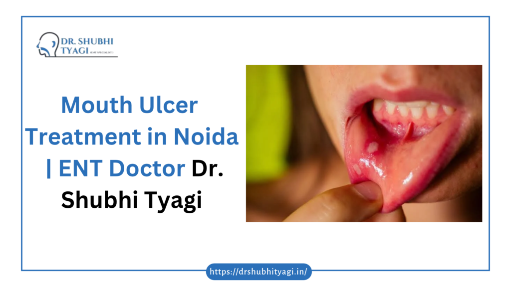 mouth ulcer treatment in noida